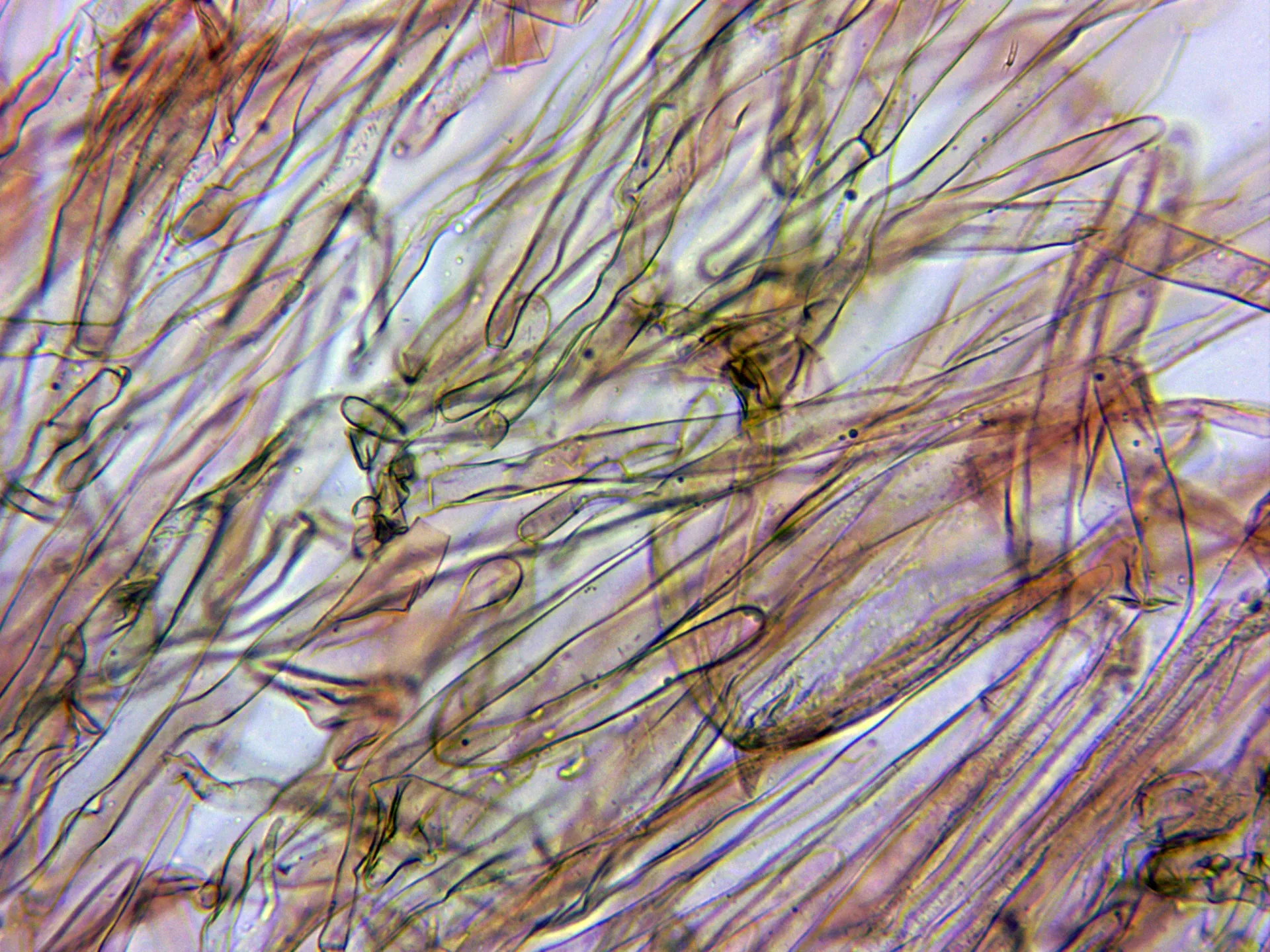 Microscopía de Lepiota clypeolaria - 10 -  Cutícula x 400 2
